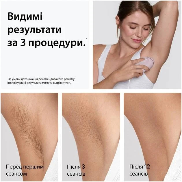 Фотоепілятор Braun Silk-expert Mini IPL (PL1111) (Pink)